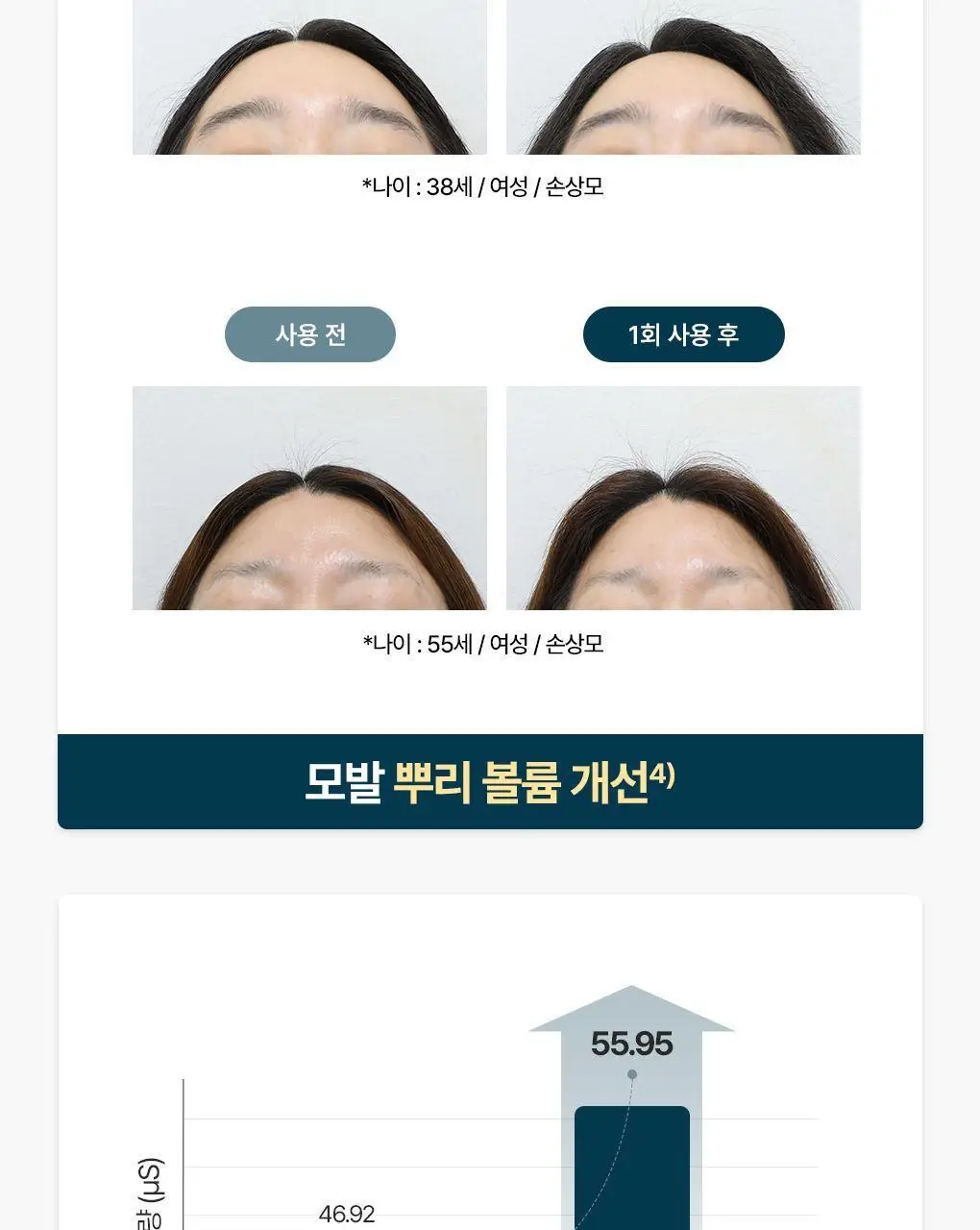 [두피뿌리볼륨]라우쉬 윌로우바크 트리트먼트 샴푸200ml&컨디셔너150ml 기획 상세페이지 18